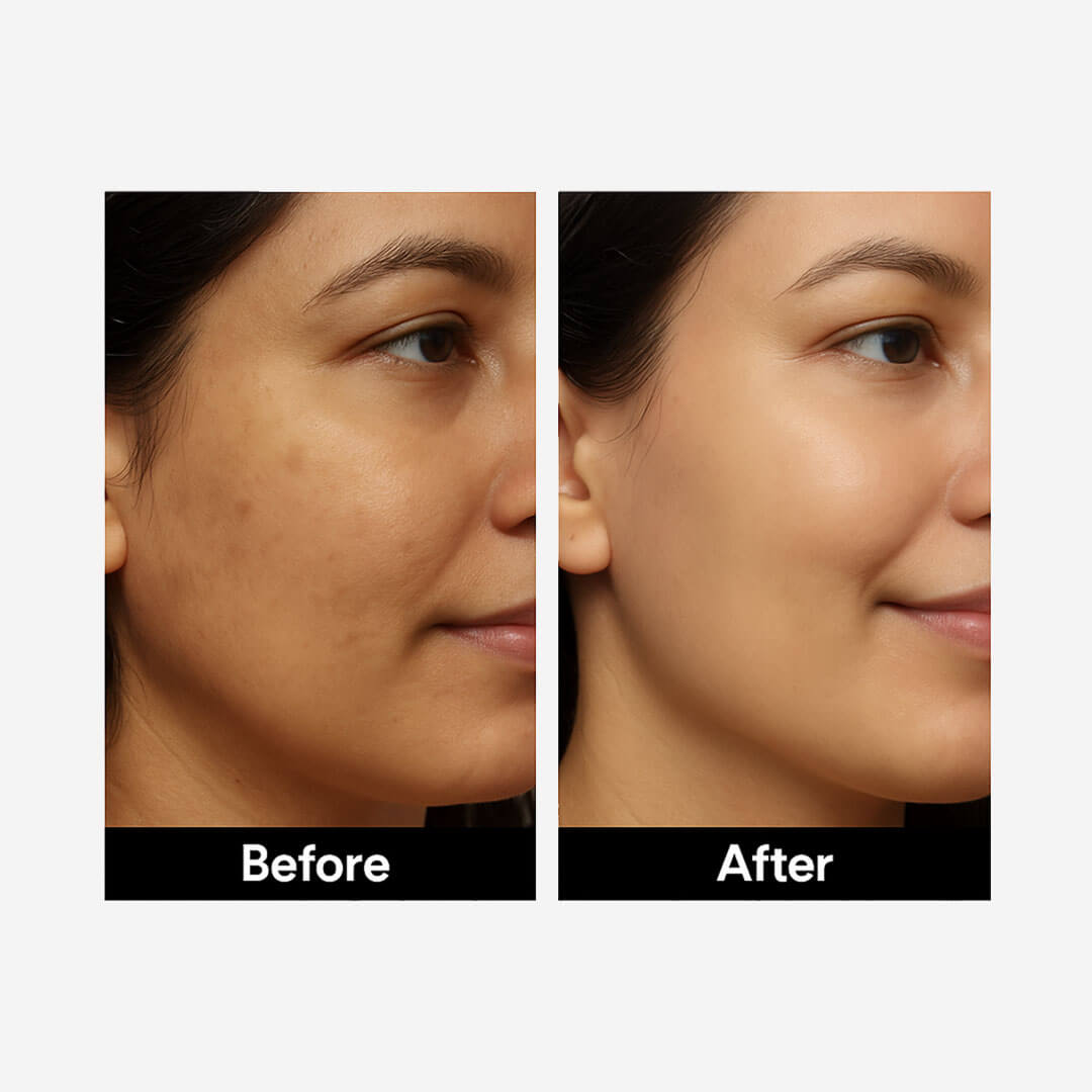 Anti-Aging Vitamin C Serum Face Serum For Men & Women